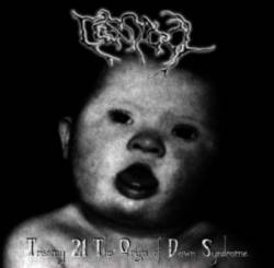 Trisomy 21 the Origin of Downsyndrome